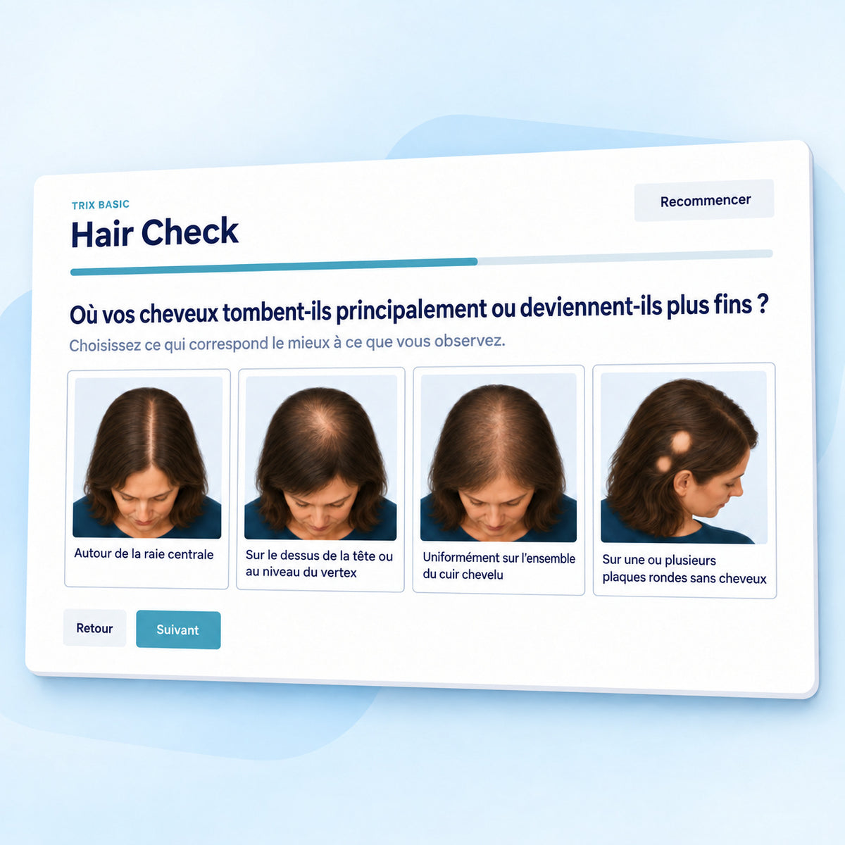 Hair Check de TRIX Basic avec des choix visuels pour différents types de chute de cheveux.
