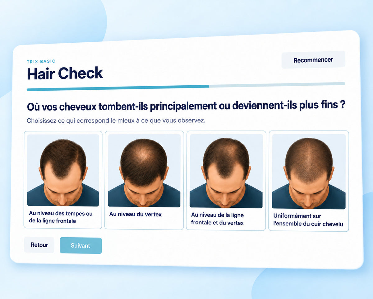 Hair Check de TRIX Basic avec des choix visuels pour les types de chute de cheveux chez les hommes.